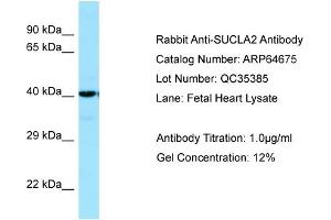 Western Blotting (WB) image for anti-Succinate-CoA Ligase, ADP-Forming, beta Subunit (SUCLA2) (C-Term) antibody (ABIN971821) (SUCLA2 抗体  (C-Term))