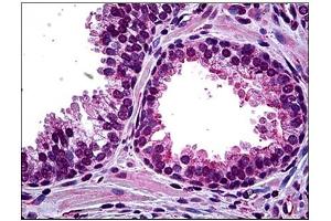 Immunohistochemistry (IHC) image for anti-Homeodomain Interacting Protein Kinase 2 (HIPK2) antibody (ABIN781914) (HIPK2 抗体)