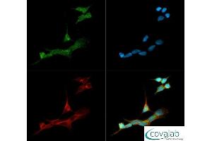 Image no. 3 for anti-Cytochrome P450, Family 19, Subfamily A, Polypeptide 1 (CYP19A1) (C-Term) antibody (ABIN363492) (Aromatase 抗体  (C-Term))