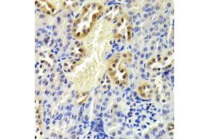 Immunohistochemistry of paraffin-embedded mouse kidney using CDKN1B Antibody (ABIN5970117) at dilution of 1/200 (40x lens). (CDKN1B 抗体)