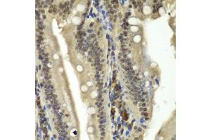 Immunohistochemistry of paraffin-embedded rat Intestine using RBBP5 antibody at dilution of 1:100 (x40 lens). (RBBP5 抗体)