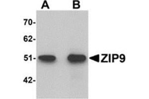 Western Blotting (WB) image for anti-Solute Carrier Family 39 (Zinc Transporter), Member 9 (SLC39A9) (N-Term) antibody (ABIN783811)