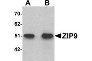 Western blot analysis of ZIP9 in HepG2 cell lysate with ZIP9 antibody at (A) 1 and (B) 2 μg/ml. (SLC39A9 抗体  (N-Term))