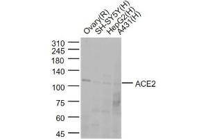 Lane 1: Rat Ovary lysates; Lane 2:SH-SY5Y cell lysates; Lane 3:HepG2 cell lysates; Lane 4: A431 cell lysates probed with ACE2 Polyclonal Antibody, Unconjugated (bs-23027R) at 1:1000 dilution and 4˚C overnight incubation. (ACE2 抗体  (AA 251-350))