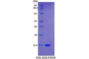 SDS-PAGE of Protein Standard from the Kit  (Highly purified E. (CTGF ELISA 试剂盒)