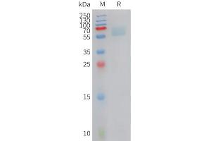 Cynomolgus AXL Protein, His Tag on SDS-PAGE under reducing condition.