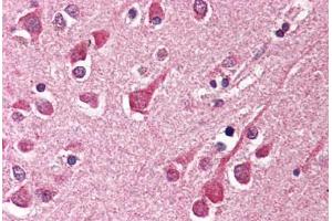 Human Brain, Cortex (formalin-fixed, paraffin-embedded) stained with KIAA1303 antibody ABIN214505 at 2. (Raptor 抗体)