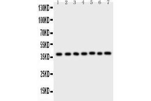 Western Blotting (WB) image for anti-Aryl Hydrocarbon Receptor Interacting Protein (AIP) (AA 91-330) antibody (ABIN3043728) (AIP 抗体  (AA 91-330))
