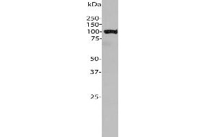 anti-Aldehyde Dehydrogenase H1L1 antibody