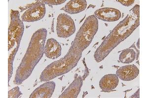 IHC analysis of EHD1 using anti-EHD1 antibody (ABIN6719599).