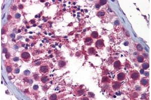 Human Testis: Formalin-Fixed, Paraffin-Embedded (FFPE) (STK38 抗体  (AA 365-466))