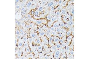 Immunohistochemistry (IHC) image for anti-Catenin (Cadherin-Associated Protein), alpha 2 (CTNNA2) (AA 150-300) antibody (ABIN7266134)