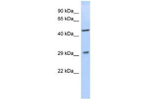 LIX1 antibody used at 1 ug/ml to detect target protein. (LIX1 抗体)