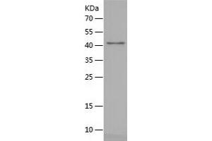 Surfactant Protein A1 Protein (SFTPA1) (AA 42-248) (His-IF2DI Tag)