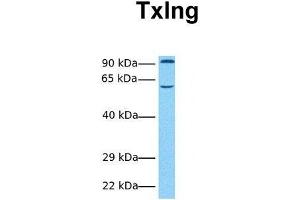 Host:  Rabbit  Target Name:  Txlng  Sample Tissue:  Human Fetal Heart  Antibody Dilution:  1. (Taxilin gamma (TXLNG) (N-Term) 抗体)