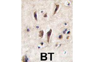 Formalin-fixed and paraffin-embedded human brain tissue reacted with TIE1 polyclonal antibody  , which was peroxidase-conjugated to the secondary antibody, followed by DAB staining. (TIE1 抗体  (N-Term))