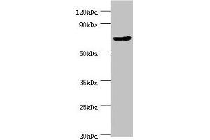 Western blot All lanes: CDC16 antibody at 4 μg/mL + Jurkat whole cell lysate Secondary Goat polyclonal to rabbit IgG at 1/10000 dilution Predicted band size: 72, 66, 61 kDa Observed band size: 72 kDa (CDC16 抗体  (AA 371-620))
