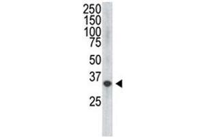 Western Blotting (WB) image for anti-C-Fos Induced Growth Factor (Vascular Endothelial Growth Factor D) (Figf) (C-Term), (N-Term) antibody (ABIN3029816)
