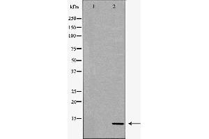 Western blot analysis of extracts of HeLa , using S100A4antibody. (s100a4 抗体  (C-Term))