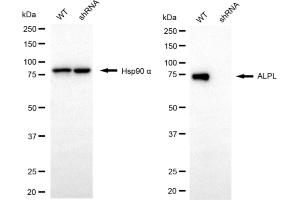 anti-Alkaline Phosphatase, Liver/bone/kidney (ALPL) antibody