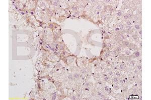 Formalin-fixed and paraffin embedded mouse small intestine tissue labeled with Anti-Phospho-GCN2 (Thr898) Polyclonal Antibody, Unconjugated (ABIN684943) at 1:200 followed by conjugation to the secondary antibody and DAB staining (GCN2 抗体  (pThr899))