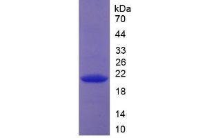 SDS-PAGE analysis of Human Collagen Type XVIII Protein. (COL18 蛋白)
