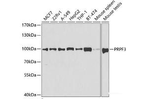 Western blot analysis of extracts of various cell lines using PRPF3 Polyclonal Antibody at dilution of 1:1000. (PRPF3 抗体)