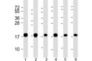 Western blot testing of human 1) A549, 2) HeLa, 3) HepG2, 4) U-2OS, 5) Jurkat and 6) placenta lysate with COMMD1 antibody at 1:2000. (COMMD1 抗体  (AA 4-33))