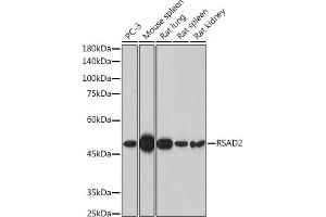 Western blot analysis of extracts of various cell lines, using RS antibody (ABIN7269832) at 1:1000 dilution. (RSAD2 抗体  (AA 42-361))