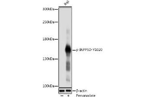 Western blot analysis of extracts of Raji cells, using Phospho-SHIP1-Y1020 antibody (ABIN6135243, ABIN6136110, ABIN6136111 and ABIN6225677) at 1:1000 dilution. (INPP5D 抗体  (pTyr1020))