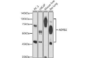 Western blot analysis of extracts of various cell lines, using  antibody (ABIN3022783, ABIN3022784, ABIN3022785 and ABIN6219227) at 1:500 dilution. (beta 2 Adrenergic Receptor 抗体  (AA 334-413))