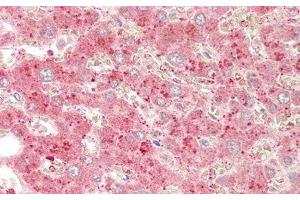 Detection of CYP1A1 in Human Liver Tissue using Polyclonal Antibody to Cytochrome P450 1A1 (CYP1A1) (CYP1A1 抗体  (AA 1-250))