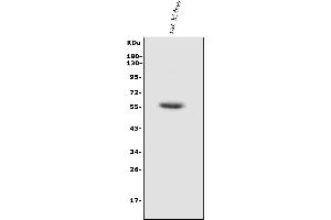 Western blot analysis of HEXA using anti-HEXA antibody (ABIN7601083).