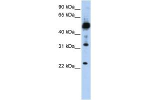 TMEM38B antibody used at 1 ug/ml to detect target protein. (TMEM38B 抗体  (C-Term))