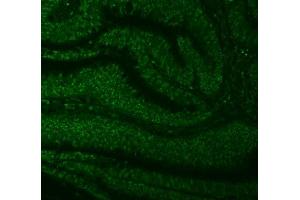 IF analysis of SNRNP27 using anti-SNRNP27 antibody (ABIN7599614).