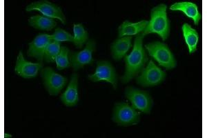 Immunofluorescence staining of A549 cells with ABIN7150750 at 1:100, counter-stained with DAPI. (DUSP15 抗体  (AA 1-295))