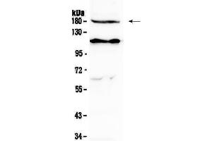 Western blot analysis of VEGF Receptor 2  using anti-VEGF Receptor 2  antibody . (VEGFR2/CD309 抗体  (AA 20-242))