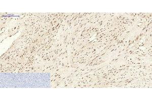 Immunohistochemistry of paraffin-embedded Human uterus tissue using CBX5 Monoclonal Antibody at dilution of 1:200. (CBX5 抗体)