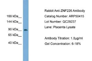 WB Suggested Anti-ZNF226  Antibody Titration: 0. (ZNF226 抗体  (Middle Region))