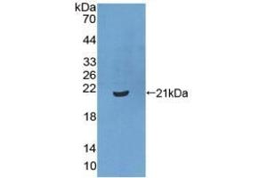 Detection of Recombinant XPo1, Human using Polyclonal Antibody to Exportin 1 (XPO1) (XPO1 抗体  (AA 917-1071))