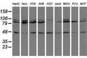 Western blot analysis of extracts (35 µg) from 9 different cell lines by using anti-CD80 monoclonal antibody. (CD80 抗体)