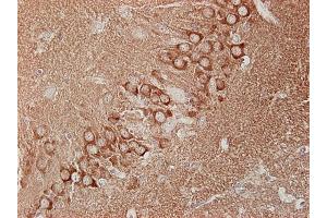 Immunohistochemistry (IHC) image for anti-Dynamin 1, 2, 3 (AA 2-17) antibody (ABIN1742248)