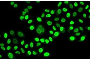 Immunofluorescence analysis of HeLa cells using NUDC Polyclonal Antibody (NUDC 抗体)