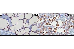 Typical pulmonal findings in SP-A (surfactant protein A) immunohistochemistry. (Surfactant Protein A1 抗体  (Internal Region))