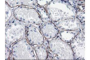 Immunohistochemical staining of paraffin-embedded Human Kidney tissue using anti-LDLRAP1 mouse monoclonal antibody. (LDLRAP1 抗体)