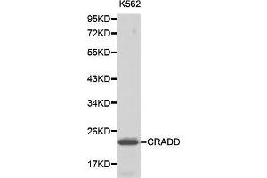 Western blot analysis of K562 cell lysate using CRADD antibody. (CRADD 抗体  (AA 1-199))