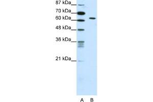 WB Suggested Anti-SMAD1 Antibody Titration:  0. (SMAD1 抗体  (C-Term))