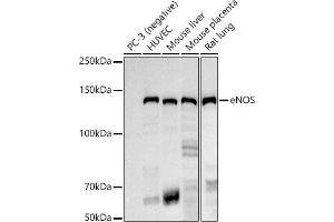 Western blot analysis of extracts of various cell lines, using eNOS antibody (ABIN7268920) at 1:1000 dilution. (ENOS 抗体)