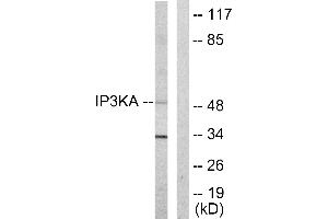 Western blot analysis of extracts from HUVEC cells, using IP3KA antibody. (ITPKA 抗体  (C-Term))