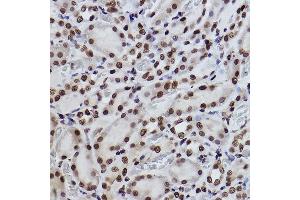 Immunohistochemistry of paraffin-embedded rat kidney using Acetyl-Histone H3-K27 Rabbit mAb (ABIN3016650, ABIN3016651, ABIN3016652, ABIN1682513 and ABIN1682514) at dilution of 1:100 (40x lens). (Histone 3 抗体  (acLys27))